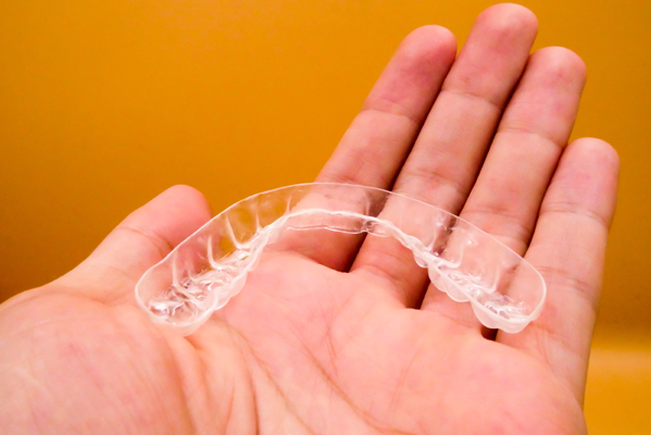 Key Differences Between SureSmile And Traditional Braces